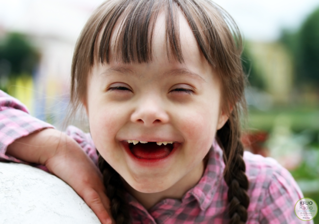 Down Syndrome