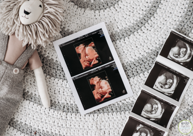 Million Dollar Match