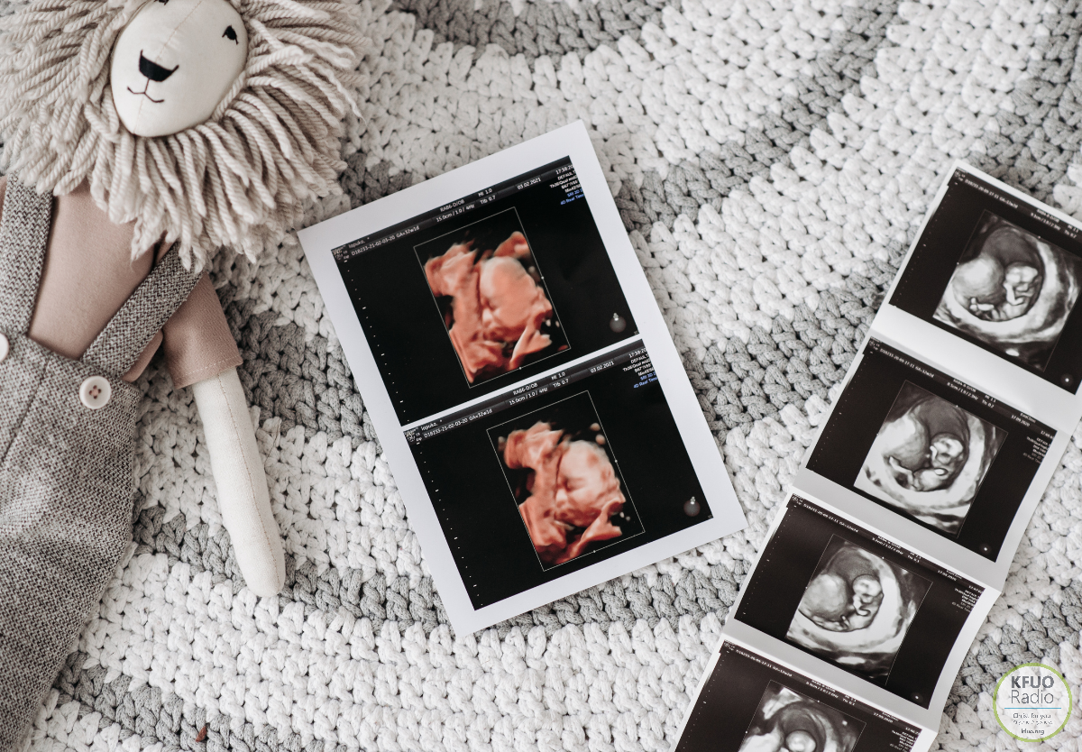 Million Dollar Match